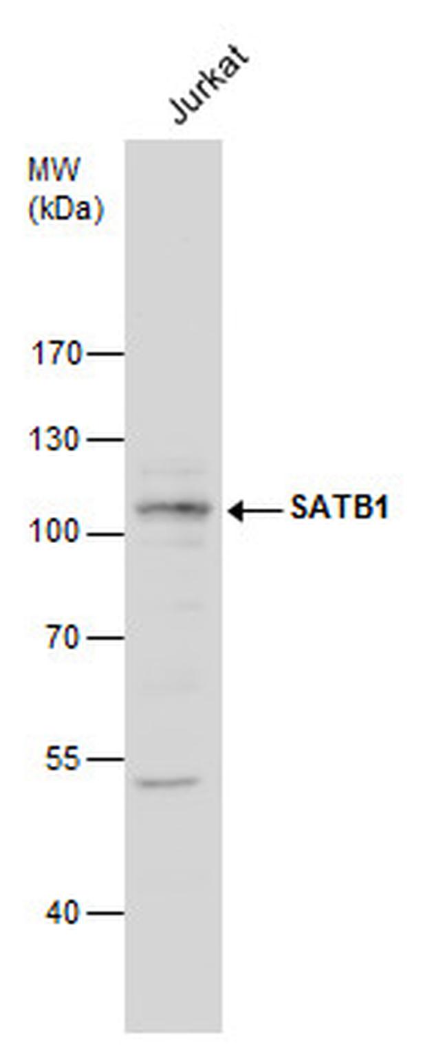 SATB1 Antibody in Western Blot (WB)