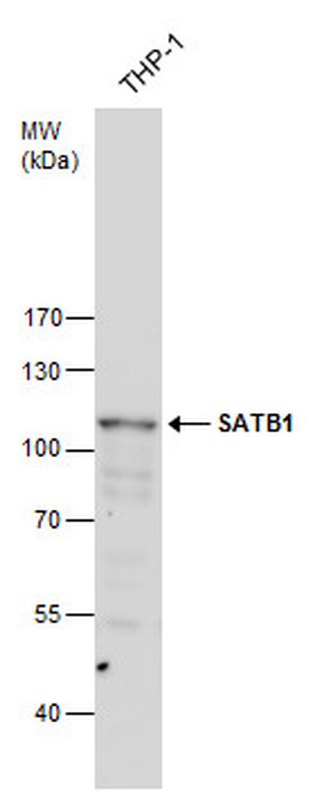 SATB1 Antibody in Western Blot (WB)