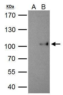 SATB1 Antibody in Immunoprecipitation (IP)