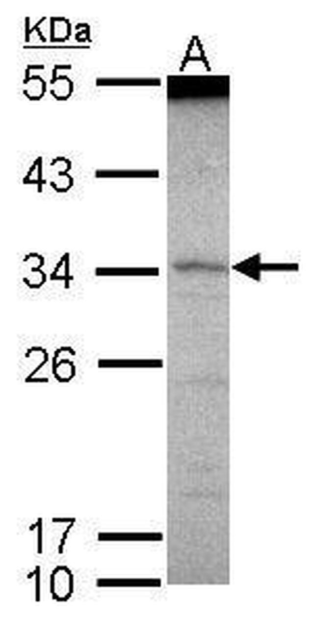 SCML1 Antibody in Western Blot (WB)