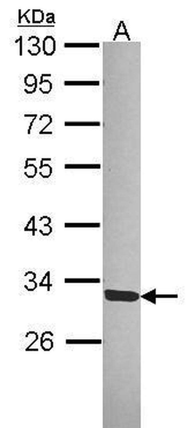 SGTA Antibody in Western Blot (WB)