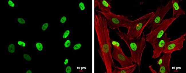 SMARCC1 Antibody in Immunocytochemistry (ICC/IF)