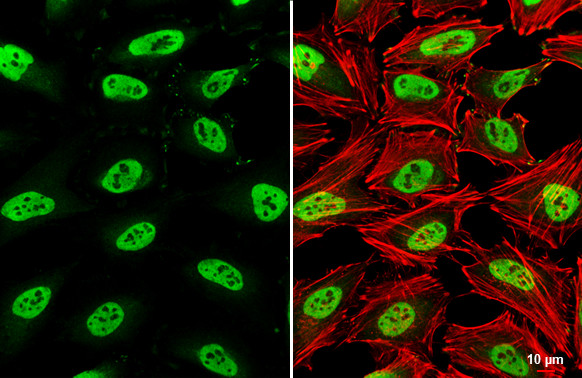 SMARCC1 Antibody in Immunocytochemistry (ICC/IF)