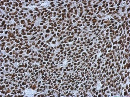 SMARCC1 Antibody in Immunohistochemistry (Paraffin) (IHC (P))