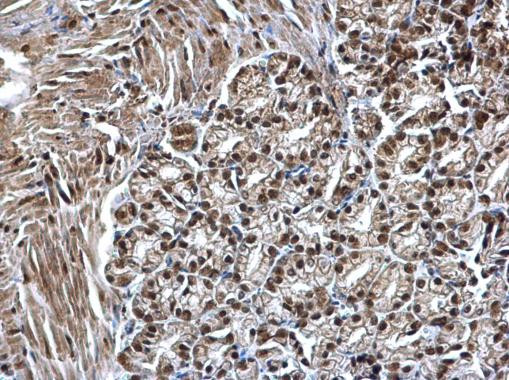 SMARCC1 Antibody in Immunohistochemistry (Paraffin) (IHC (P))