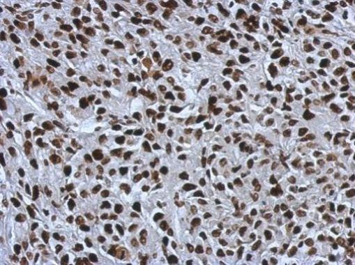 SMARCC1 Antibody in Immunohistochemistry (Paraffin) (IHC (P))