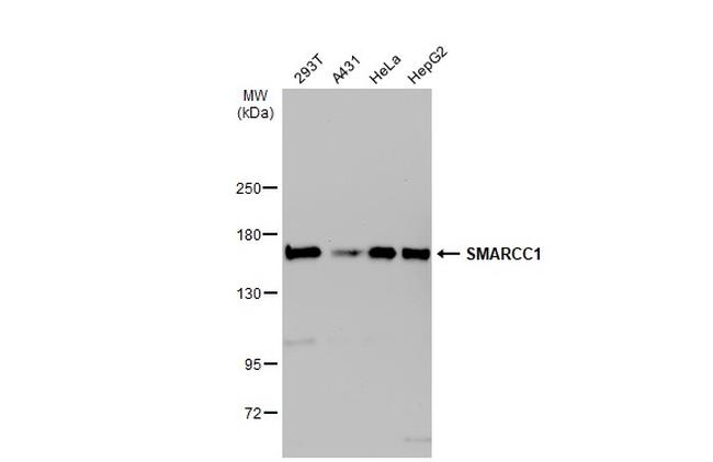 SMARCC1 Antibody in Western Blot (WB)