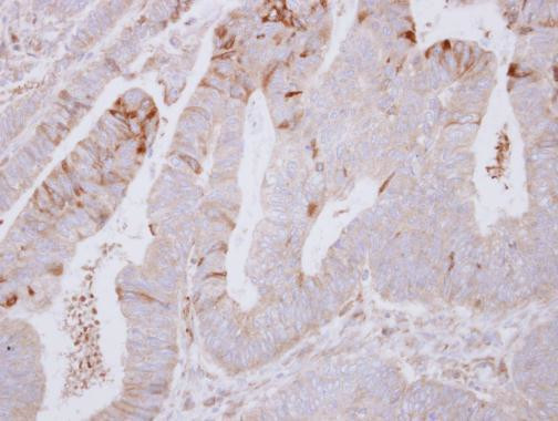 SNX2 Antibody in Immunohistochemistry (Paraffin) (IHC (P))