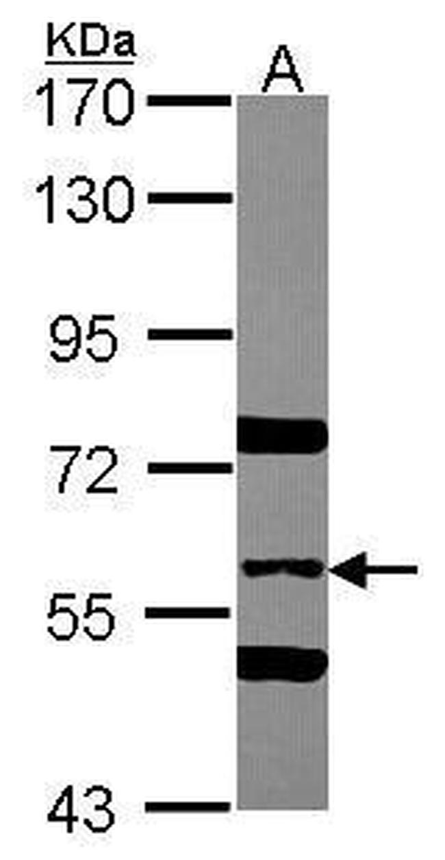 SNX2 Antibody in Western Blot (WB)