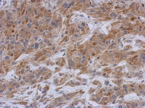 MUNC18 Antibody in Immunohistochemistry (Paraffin) (IHC (P))