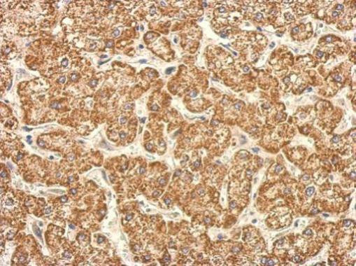 TST Antibody in Immunohistochemistry (Paraffin) (IHC (P))