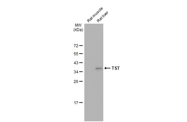 TST Antibody in Western Blot (WB)