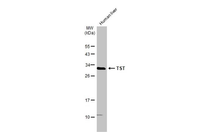 TST Antibody in Western Blot (WB)