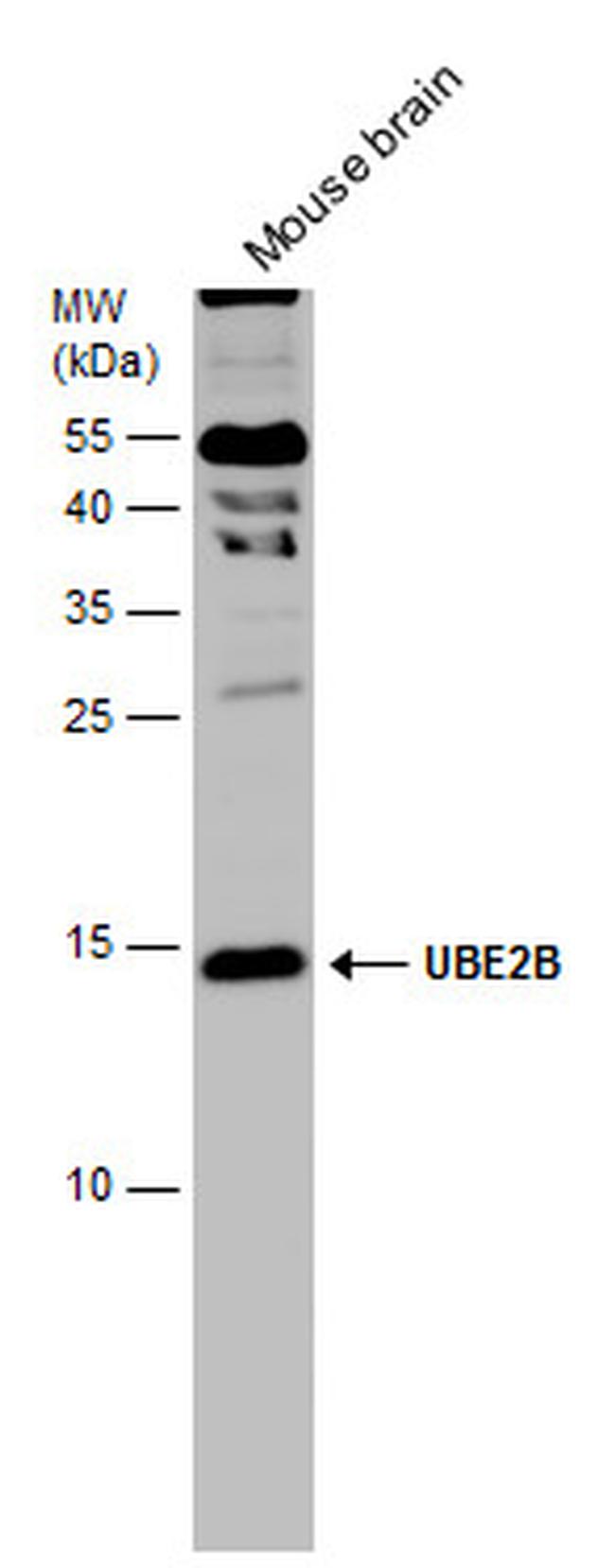 UBE2B Antibody in Western Blot (WB)