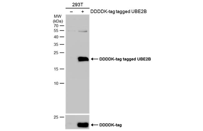 UBE2B Antibody in Western Blot (WB)