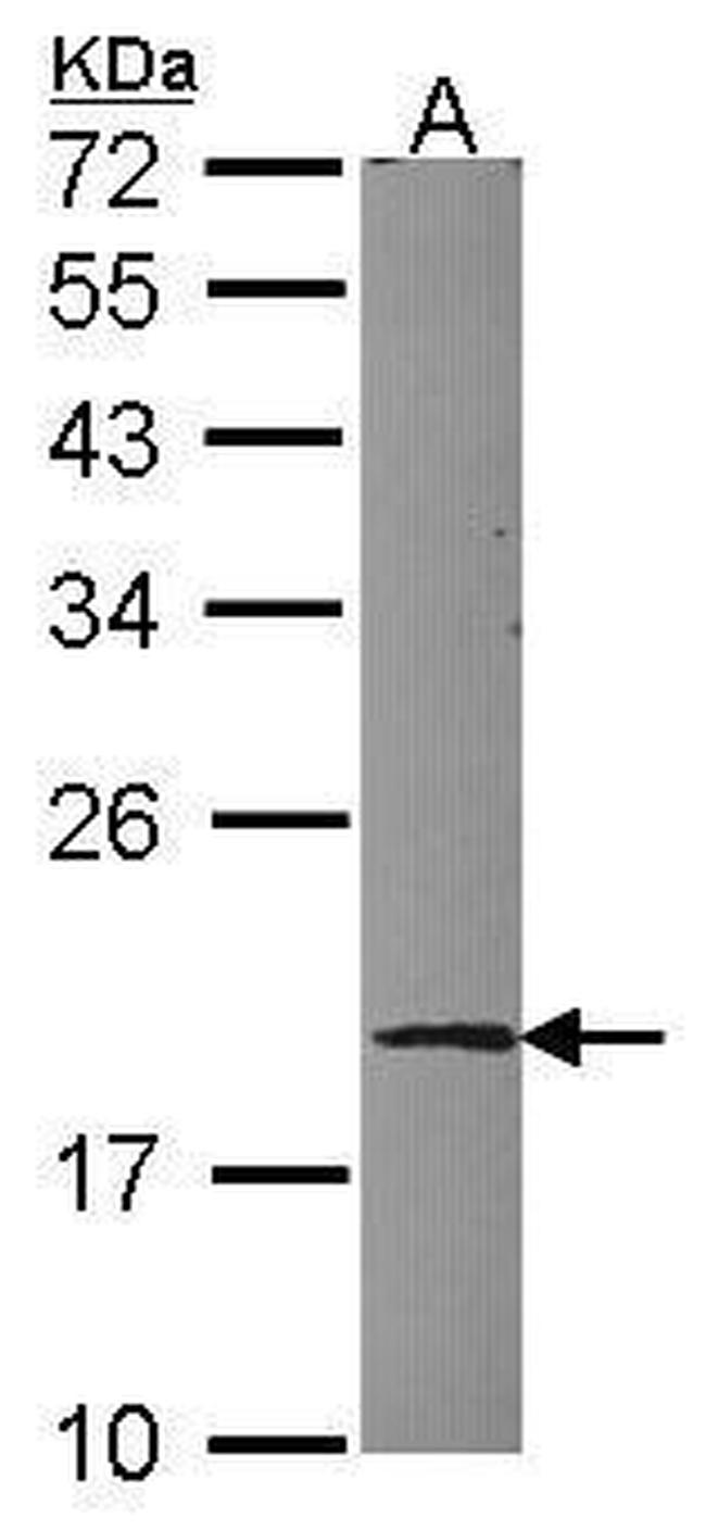 UBE2G1 Antibody in Western Blot (WB)