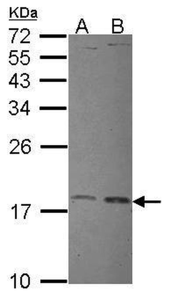 UBE2L3 Antibody in Western Blot (WB)