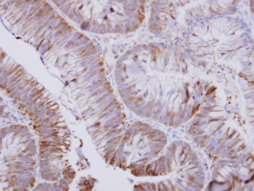 UMPS Antibody in Immunohistochemistry (Paraffin) (IHC (P))