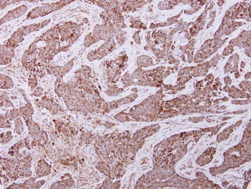 UQCRC2 Antibody in Immunohistochemistry (Paraffin) (IHC (P))