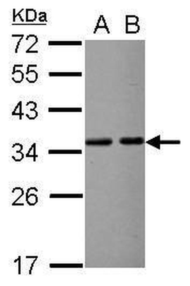 VDAC2 Antibody in Western Blot (WB)