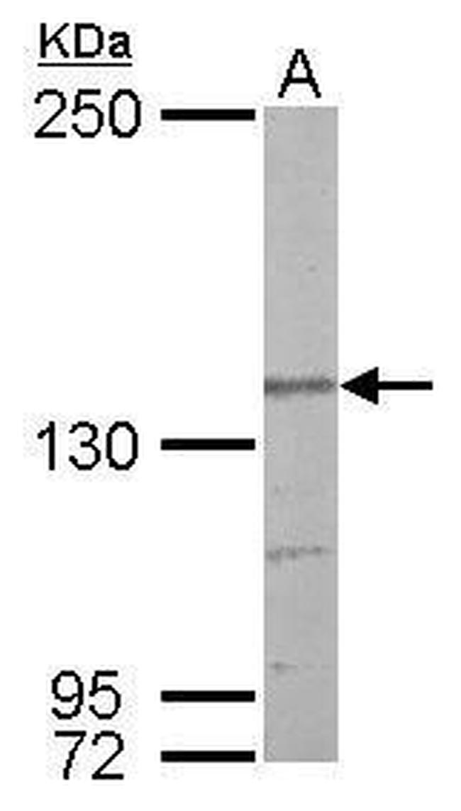 Nardilysin Antibody in Western Blot (WB)