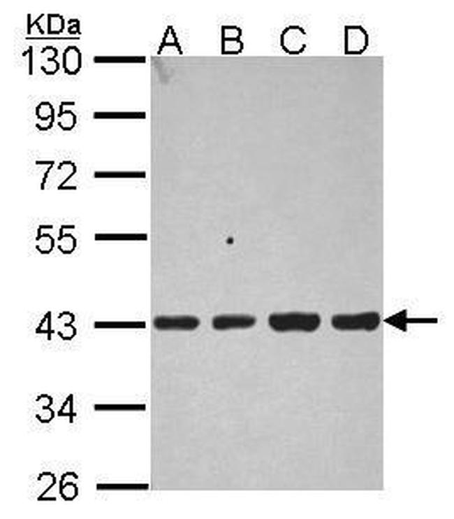 Aldolase B Antibody in Western Blot (WB)