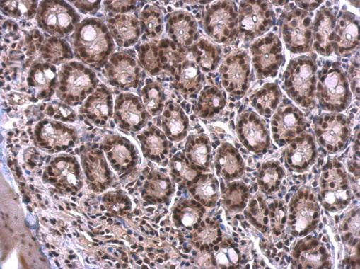 SRSF1 Antibody in Immunohistochemistry (Paraffin) (IHC (P))