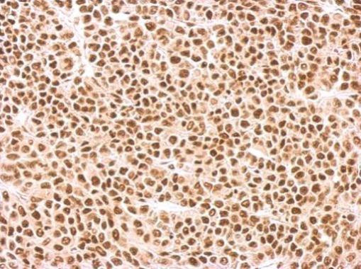 SRSF1 Antibody in Immunohistochemistry (Paraffin) (IHC (P))