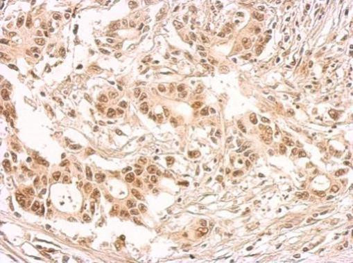 SRSF1 Antibody in Immunohistochemistry (Paraffin) (IHC (P))