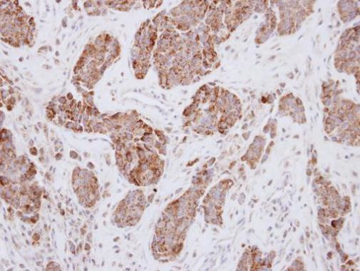 PCK2 Antibody in Immunohistochemistry (Paraffin) (IHC (P))