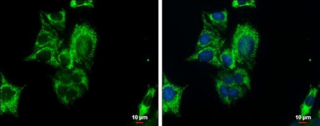 PCK2 Antibody in Immunocytochemistry (ICC/IF)