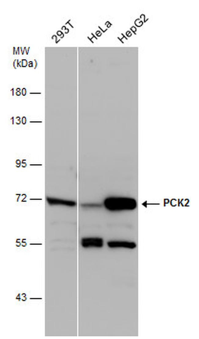 PCK2 Antibody in Western Blot (WB)