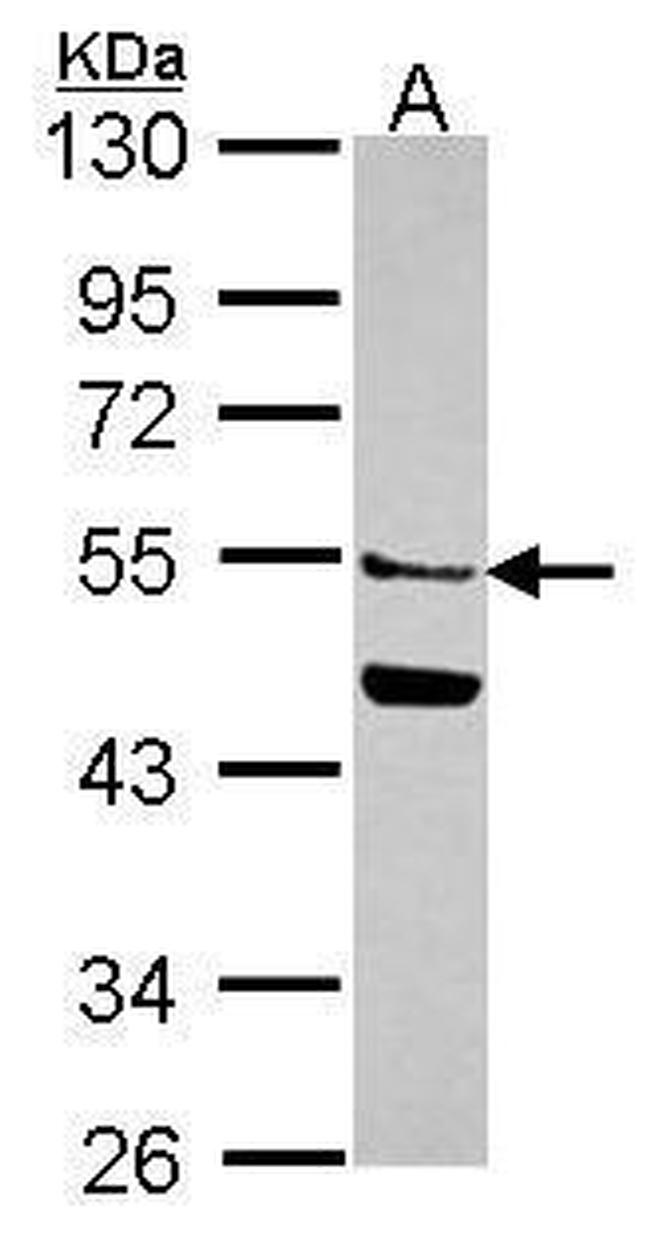 MGAT2 Antibody in Western Blot (WB)