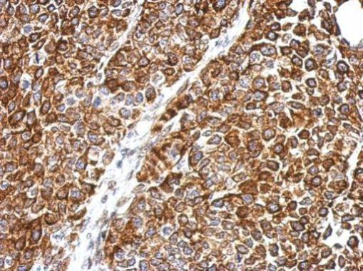 DPH2 Antibody in Immunohistochemistry (Paraffin) (IHC (P))