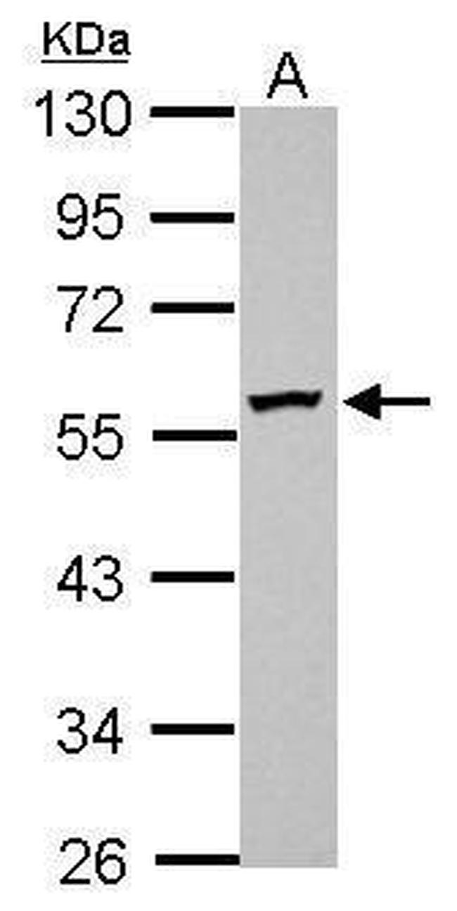 DPH2 Antibody in Western Blot (WB)