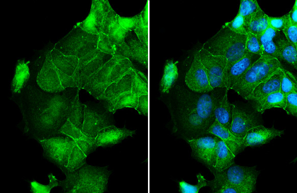 Occludin Antibody in Immunocytochemistry (ICC/IF)