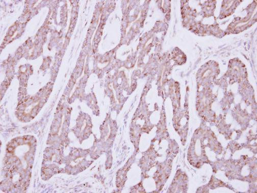 Occludin Antibody in Immunohistochemistry (Paraffin) (IHC (P))