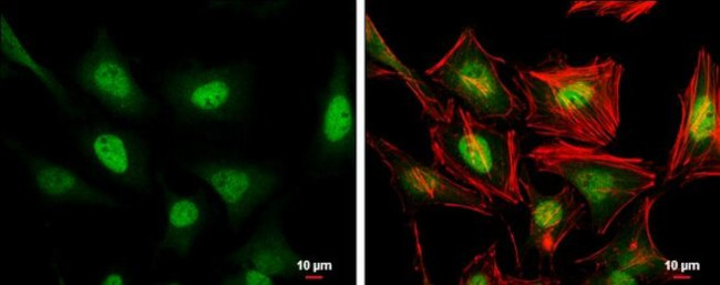 ERF Antibody in Immunocytochemistry (ICC/IF)