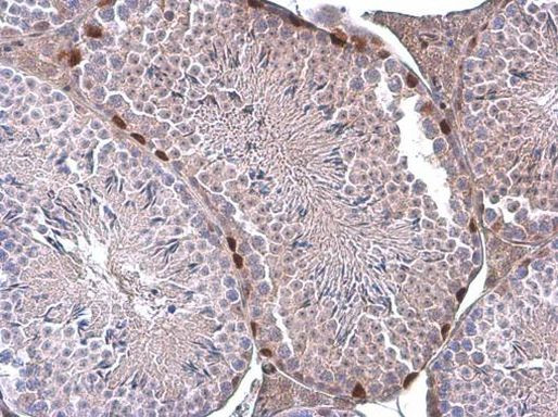 ERF Antibody in Immunohistochemistry (Paraffin) (IHC (P))