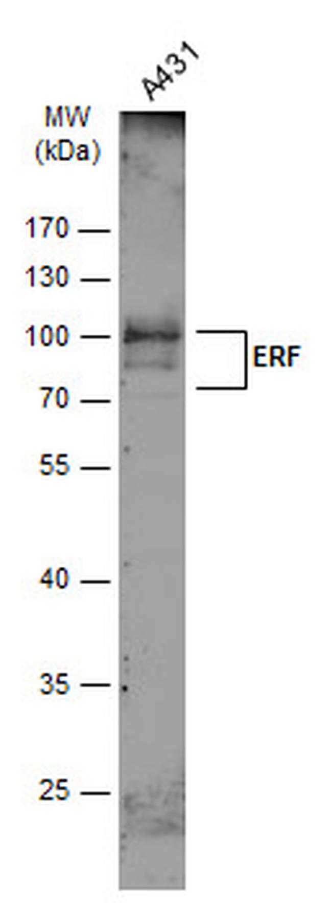 ERF Antibody in Western Blot (WB)