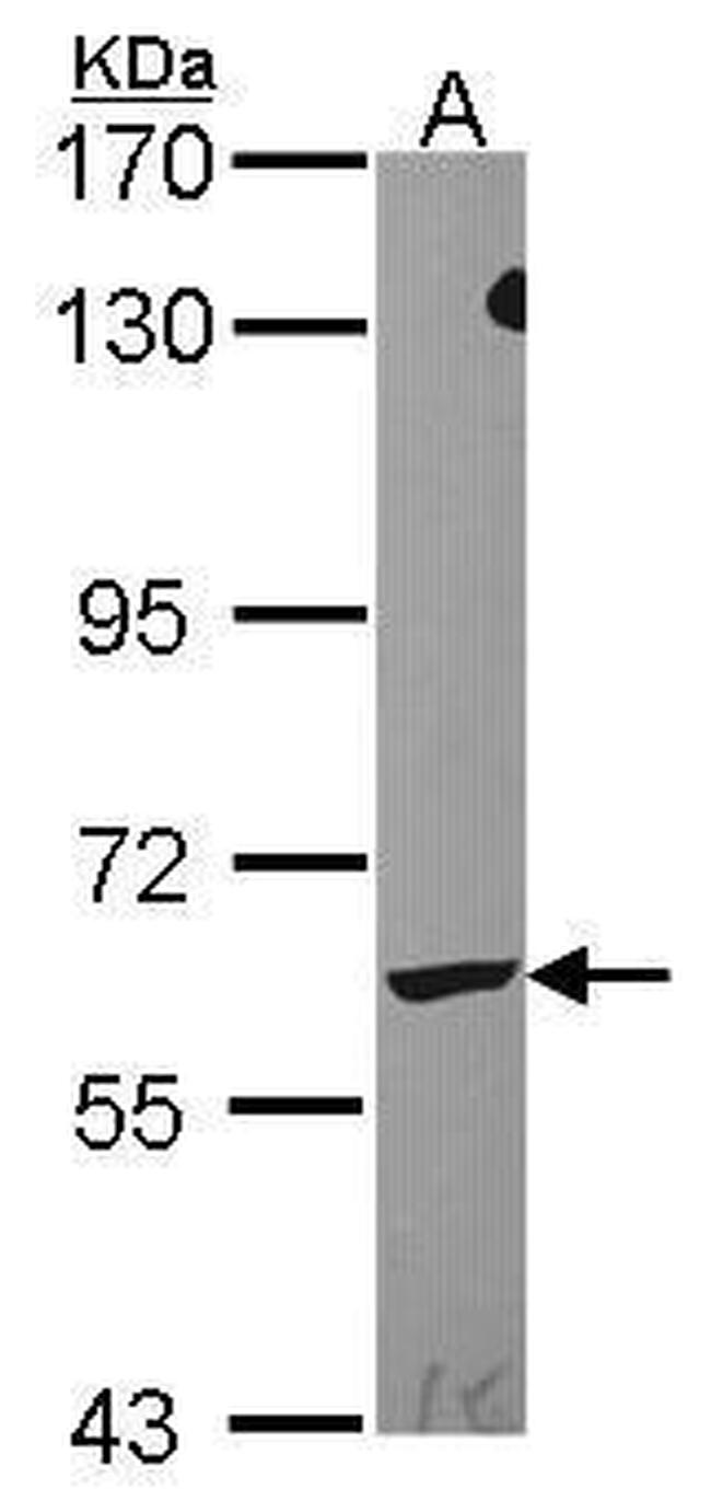 LTA4H Antibody in Western Blot (WB)