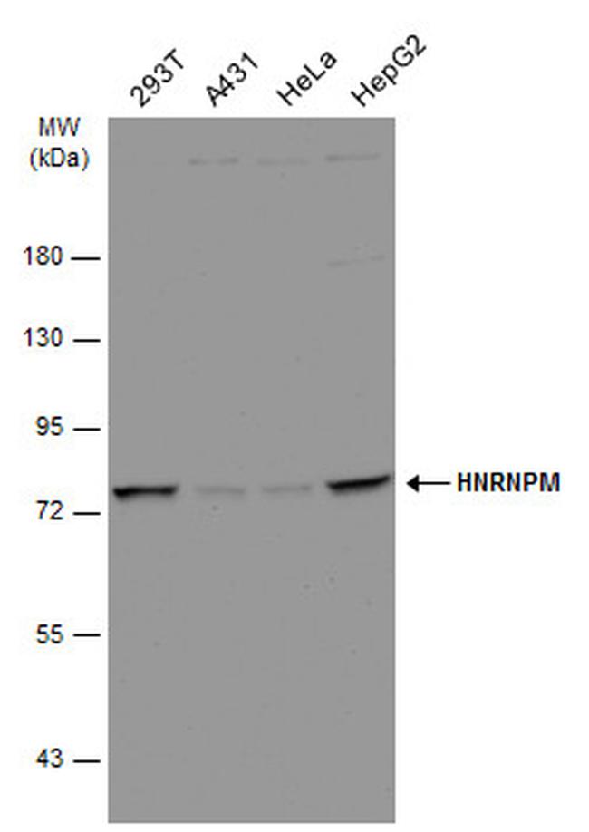 hnRNP M Antibody in Western Blot (WB)