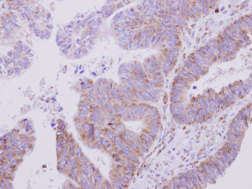 VARS Antibody in Immunohistochemistry (Paraffin) (IHC (P))