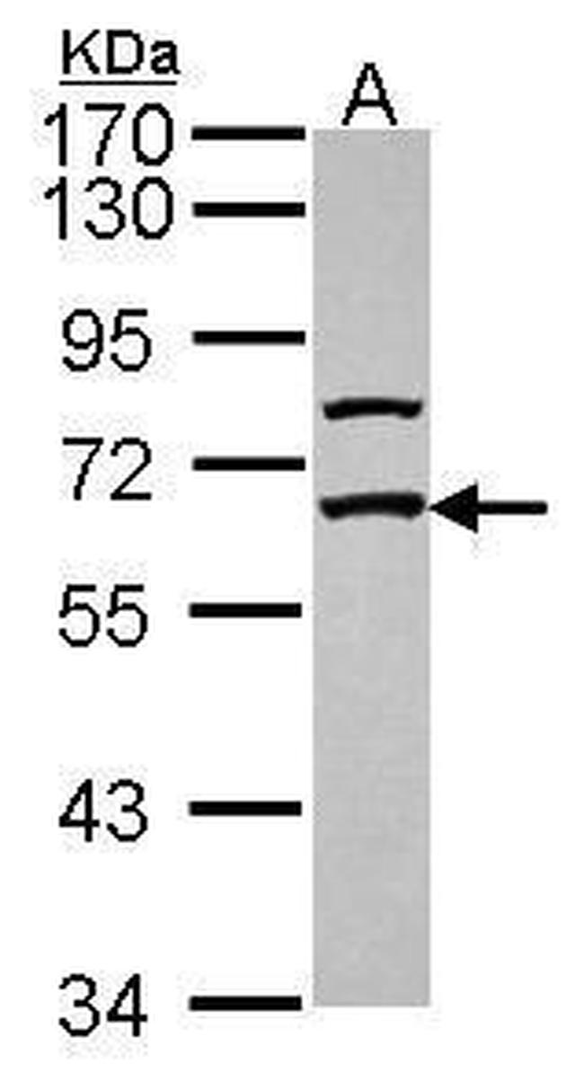 GABRE Antibody in Western Blot (WB)