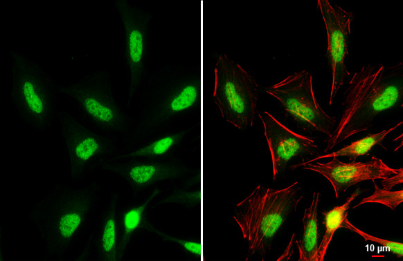 BRD3 Antibody in Immunocytochemistry (ICC/IF)