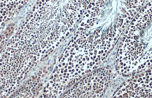 BRD3 Antibody in Immunohistochemistry (Paraffin) (IHC (P))