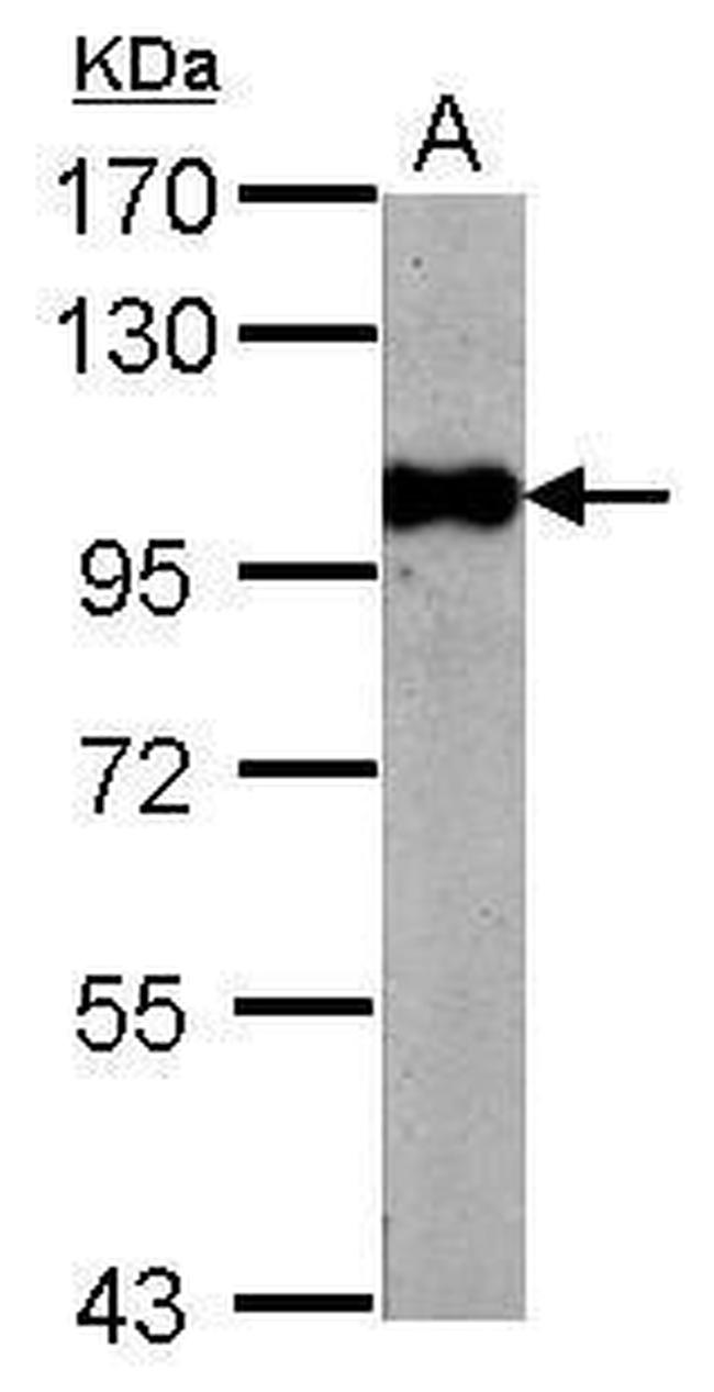 BRD3 Antibody in Western Blot (WB)