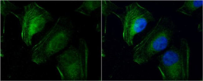 TAGLN2 Antibody in Immunocytochemistry (ICC/IF)