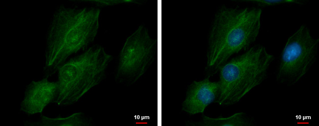 TAGLN2 Antibody in Immunocytochemistry (ICC/IF)