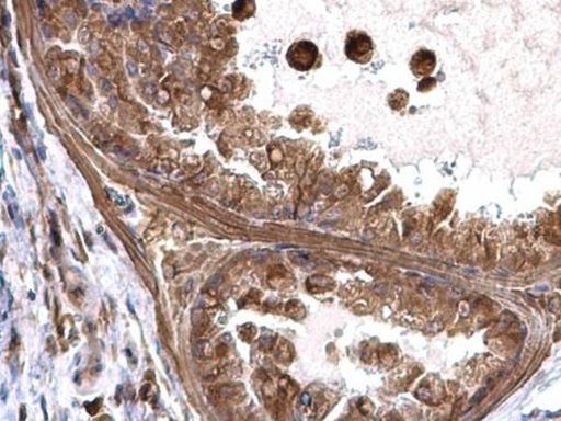 TAGLN2 Antibody in Immunohistochemistry (Paraffin) (IHC (P))